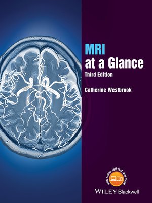 cover image of MRI at a Glance